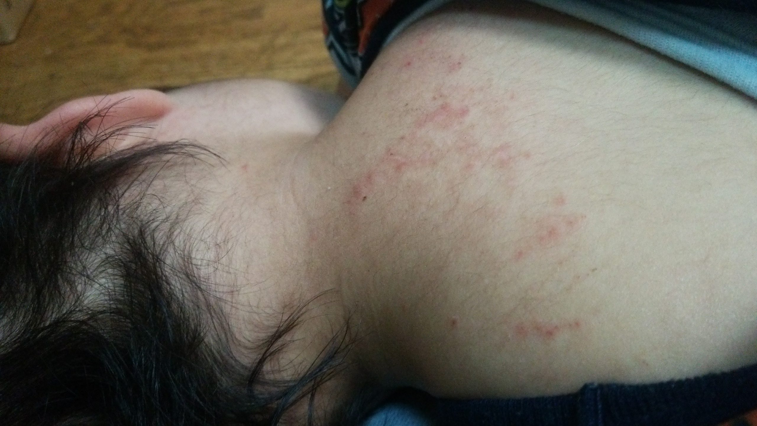 幼い頃の虐待の記憶を引きずるサバイバーたち｜後天的な発達障害とは？愛着障害で摂食障害だったわが子